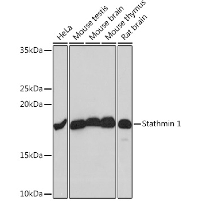 Stathmin 1 Rabbit Monoclonal Antibody