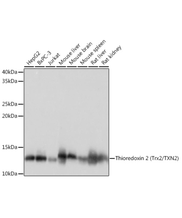 Thioredoxin 2 (Trx2/TXN2) Rabbit Monoclonal Antibody