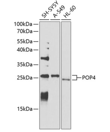 POP4 Rabbit Polyclonal Antibody