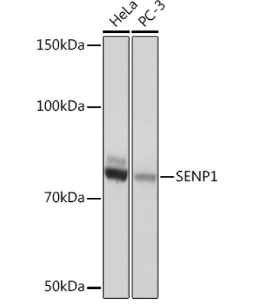 SENP1 Rabbit Monoclonal Antibody
