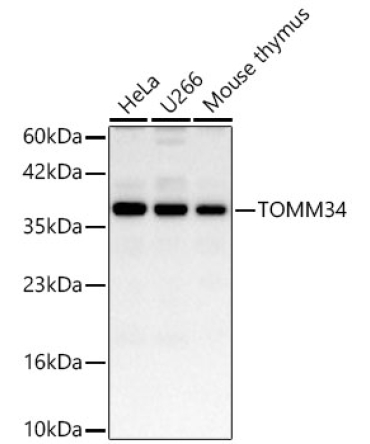 TOMM34 Rabbit Polyclonal Antibody