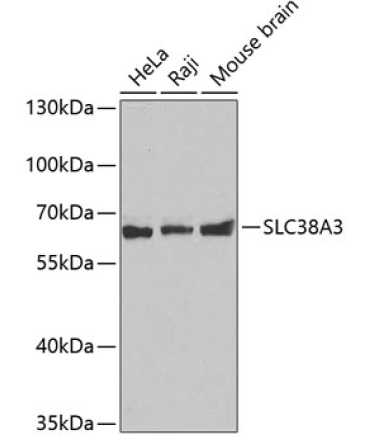 SLC38A3 Rabbit Polyclonal Antibody
