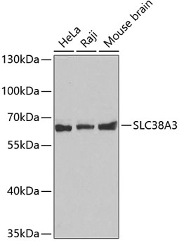 SLC38A3 Rabbit Polyclonal Antibody