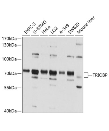 TRIOBP Rabbit Polyclonal Antibody