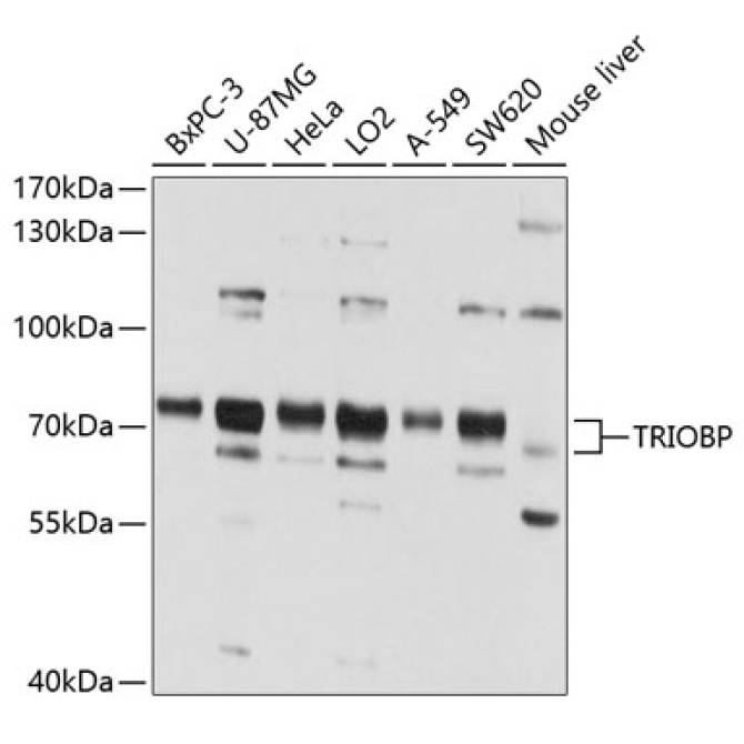 TRIOBP Rabbit Polyclonal Antibody