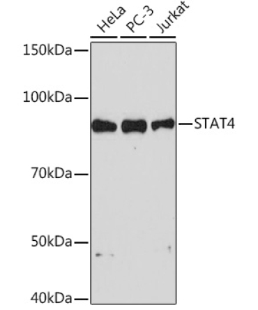 STAT4 Rabbit Monoclonal Antibody