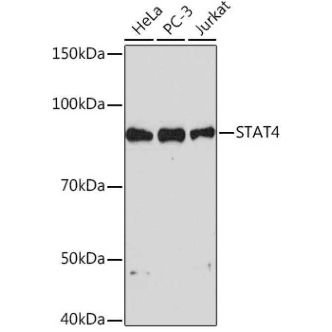 STAT4 Rabbit Monoclonal Antibody