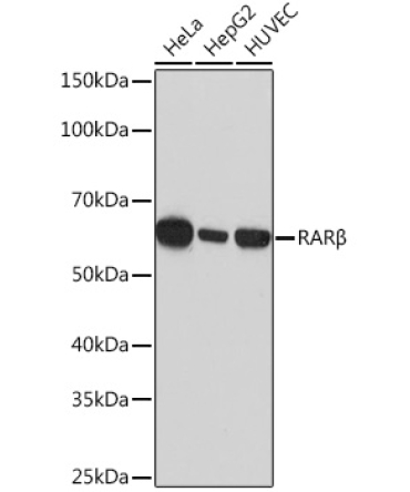RARBeta Rabbit Monoclonal Antibody