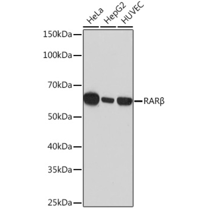 RARBeta Rabbit Monoclonal Antibody