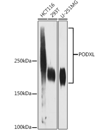 PODXL Rabbit Monoclonal Antibody