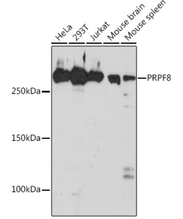 PRPF8 Rabbit Monoclonal Antibody