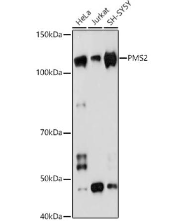 PMS2 Rabbit Monoclonal Antibody