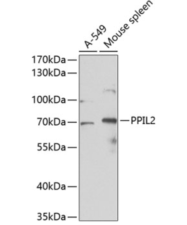 PPIL2 Rabbit Polyclonal Antibody