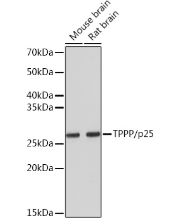 TPPP/p25 Rabbit Monoclonal Antibody