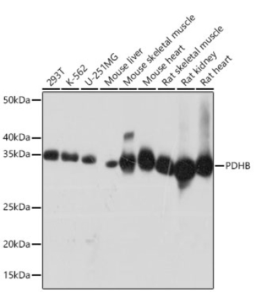 PDHB Rabbit Monoclonal Antibody