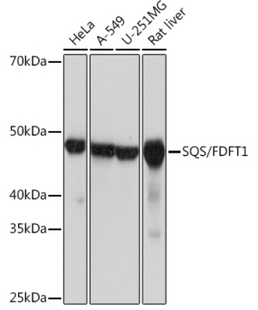 SQS/FDFT1 Rabbit Monoclonal Antibody