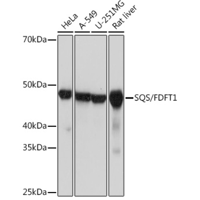 SQS/FDFT1 Rabbit Monoclonal Antibody