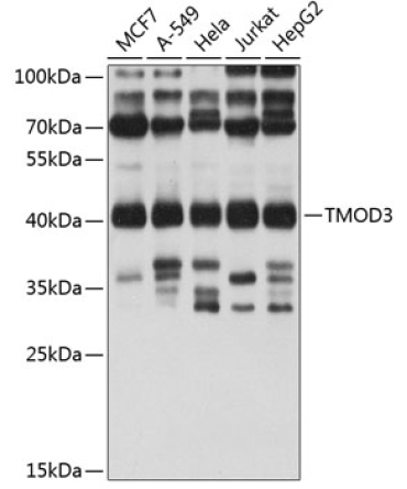 TMOD3 Rabbit Polyclonal Antibody