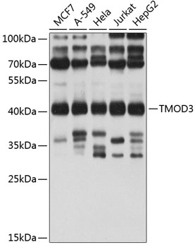 TMOD3 Rabbit Polyclonal Antibody