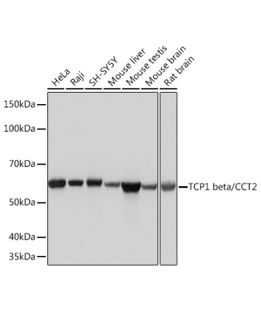TCP1 beta/CCT2 Rabbit Monoclonal Antibody