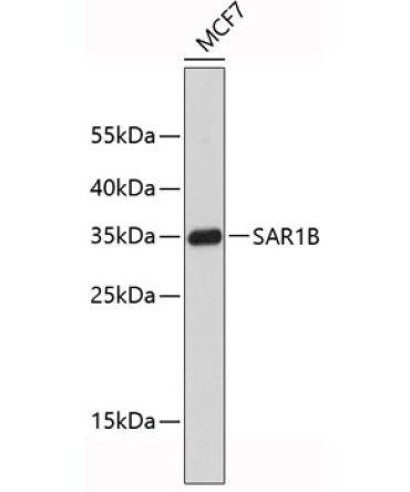 SAR1B Rabbit Polyclonal Antibody