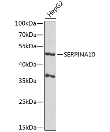 SERPINA10 Rabbit Polyclonal Antibody
