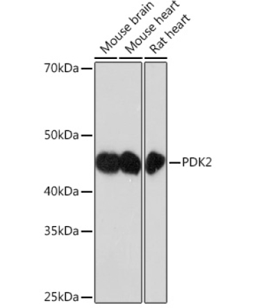 PDK2 Rabbit Monoclonal Antibody