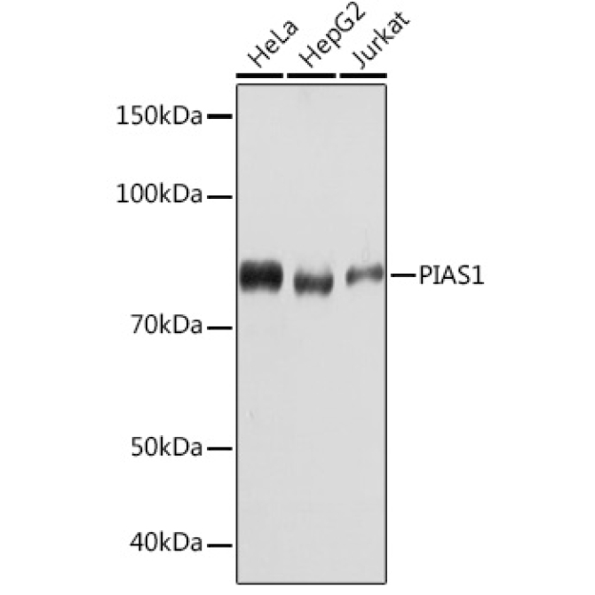 PIAS1 Rabbit Monoclonal Antibody