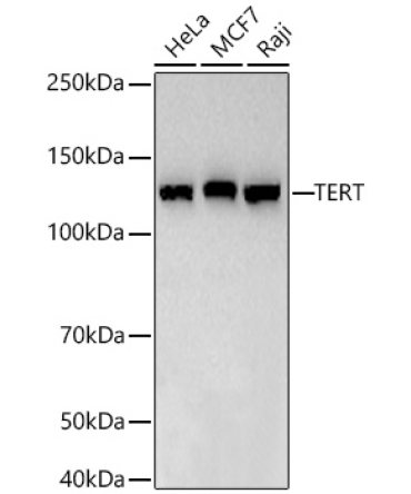 TERT Rabbit Monoclonal Antibody