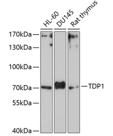 TDP1 Rabbit Polyclonal Antibody