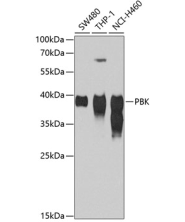SPK Rabbit Polyclonal Antibody