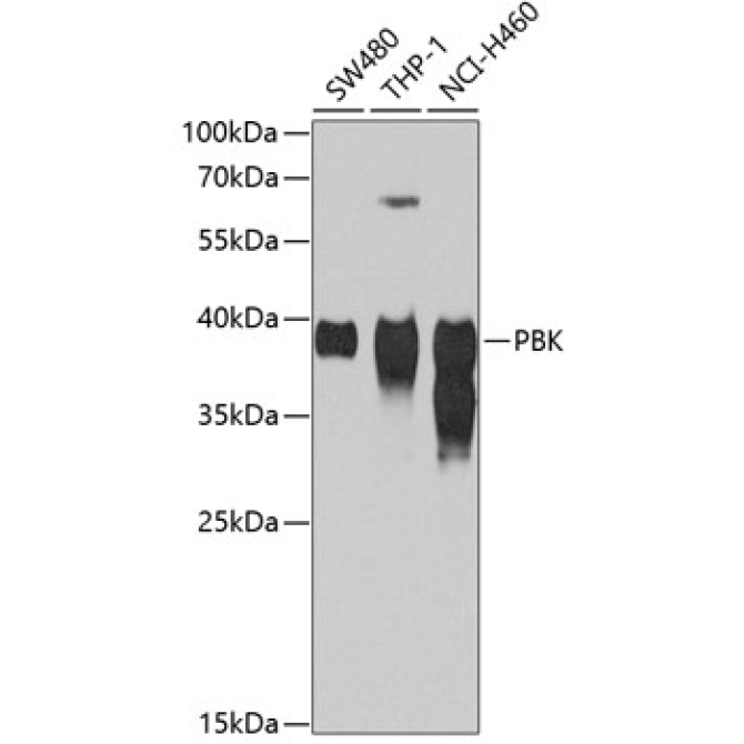SPK Rabbit Polyclonal Antibody