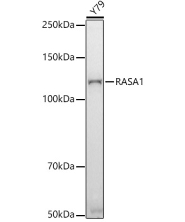 RASA1 Rabbit Monoclonal Antibody