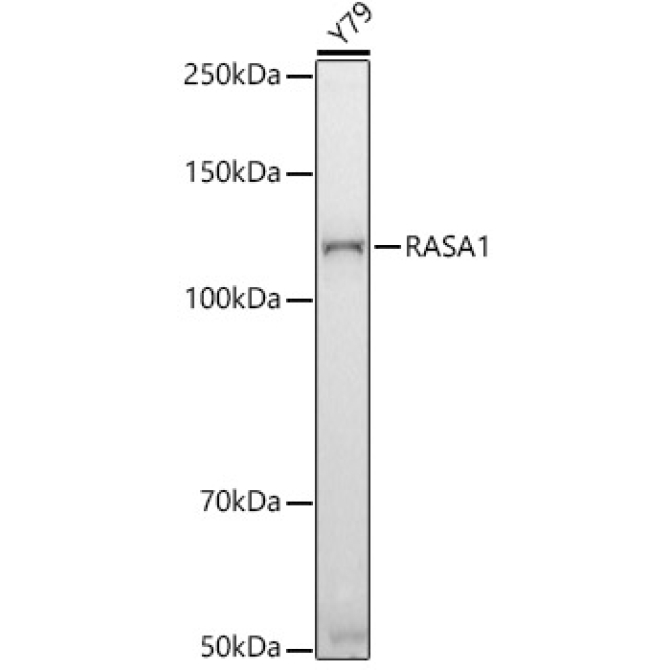 RASA1 Rabbit Monoclonal Antibody