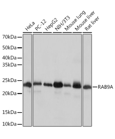 RAB9A Rabbit Monoclonal Antibody