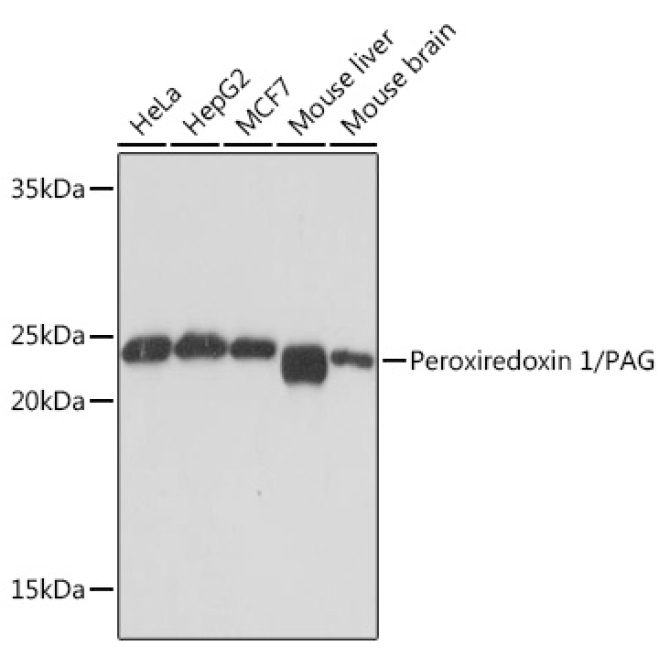 Peroxiredoxin 1/PAG Rabbit Monoclonal Antibody
