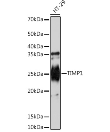 TIMP1 Rabbit Monoclonal Antibody