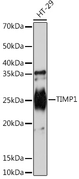 TIMP1 Rabbit Monoclonal Antibody