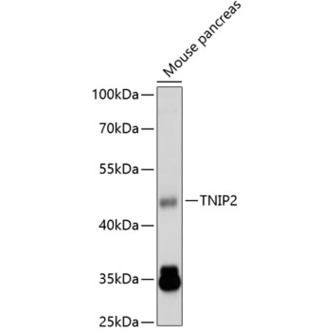 TNIP2 Rabbit Polyclonal Antibody