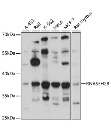 RNASEH2B Rabbit Polyclonal Antibody