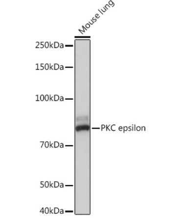 PKC epsilon Rabbit Monoclonal Antibody