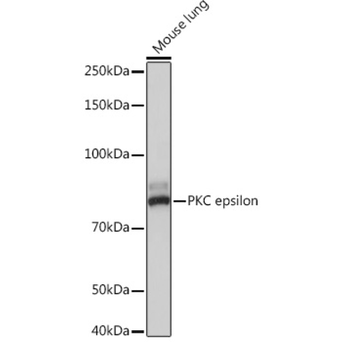 PKC epsilon Rabbit Monoclonal Antibody