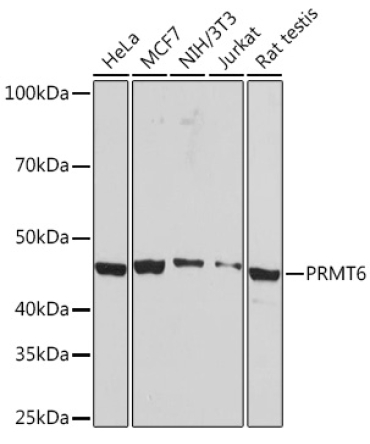 PRMT6 Rabbit Monoclonal Antibody