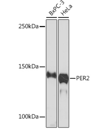 PER2 Rabbit Monoclonal Antibody