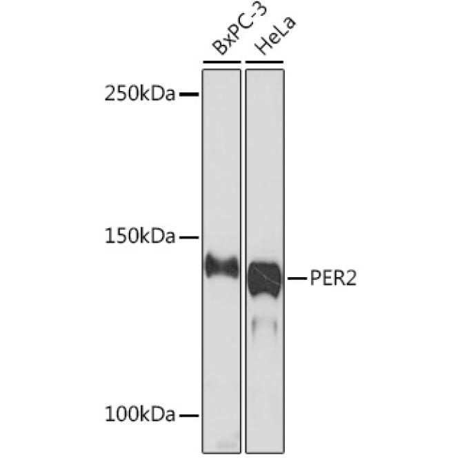 PER2 Rabbit Monoclonal Antibody
