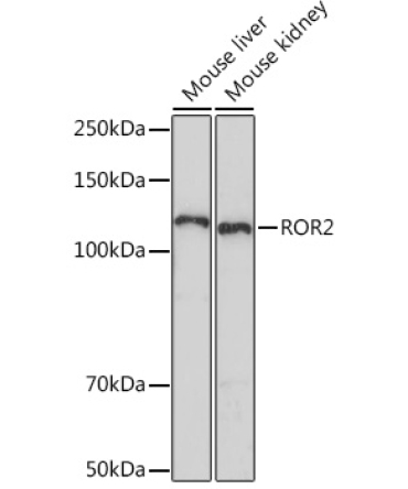 ROR2 Rabbit Monoclonal Antibody