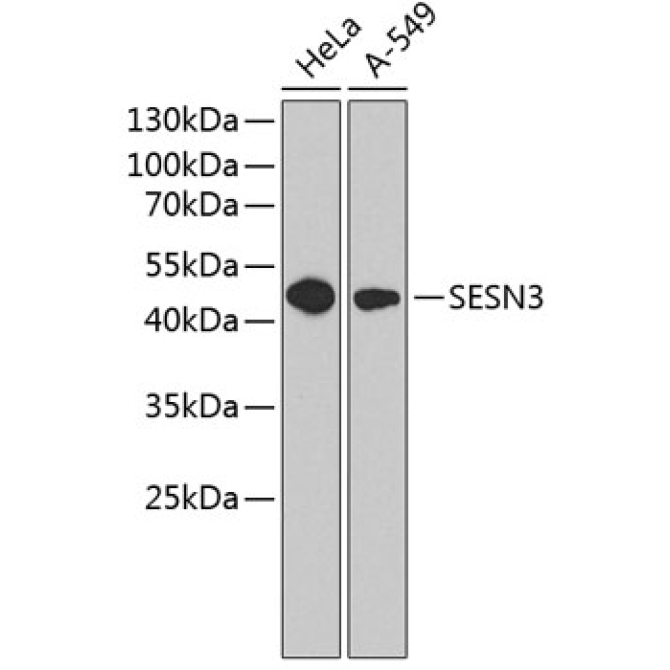 SESN3 Rabbit Polyclonal Antibody