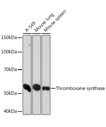 Thromboxane synthase Rabbit Monoclonal Antibody