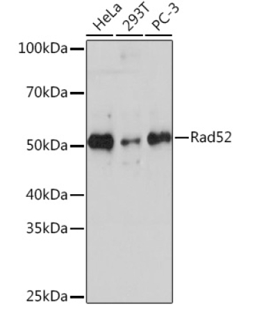 Rad52 Rabbit Monoclonal Antibody