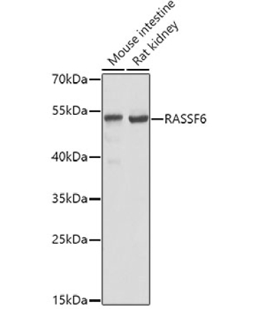 RASSF6 Rabbit Polyclonal Antibody